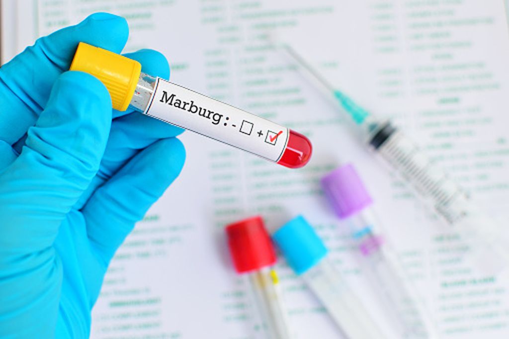 Marburg virus