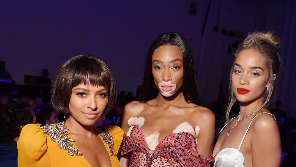 Winnie Harlow (Foto: Getty Images) (Foto: ) Winnie Harlow (Foto: Getty Images)