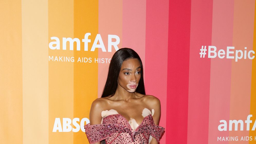 Winnie Harlow (Foto: Getty Images) (Foto: ) Winnie Harlow (Foto: Getty Images)