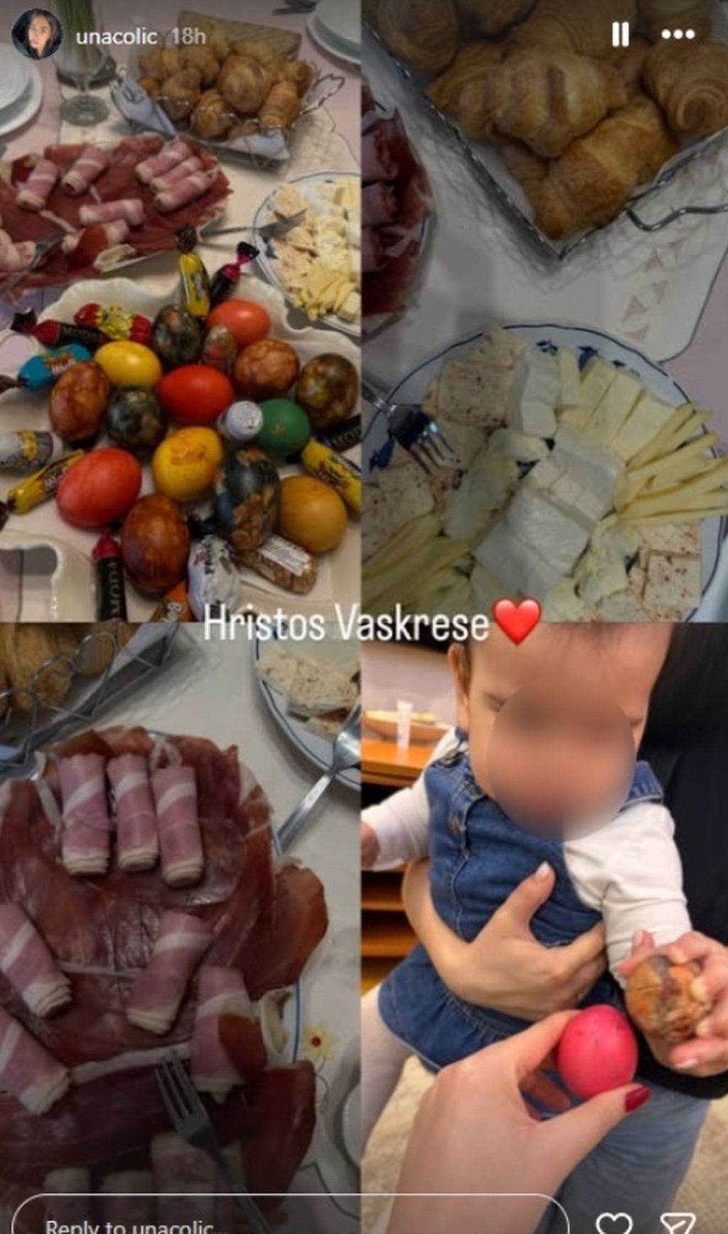 Una Čolić na Instagramu - 3