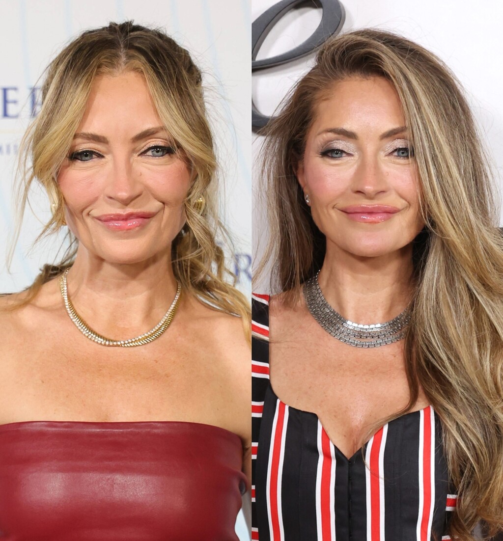 Rebecca Gayheart prije i poslije facelifta (zatezanja lica)