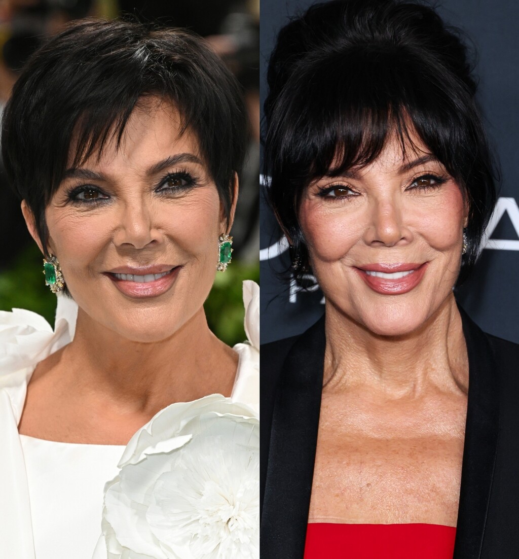 Kris Jenner prije i poslije facelifta (zatezanja lica)
