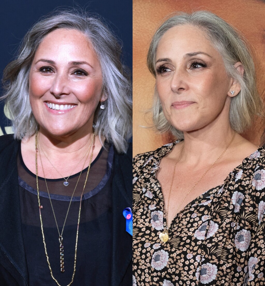 Ricki Lake prije i poslije facelifta (zatezanja lica)