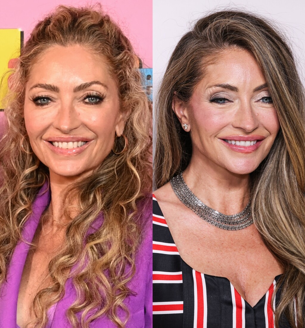 Rebecca Gayheart prije i poslije facelifta (zatezanja lica)