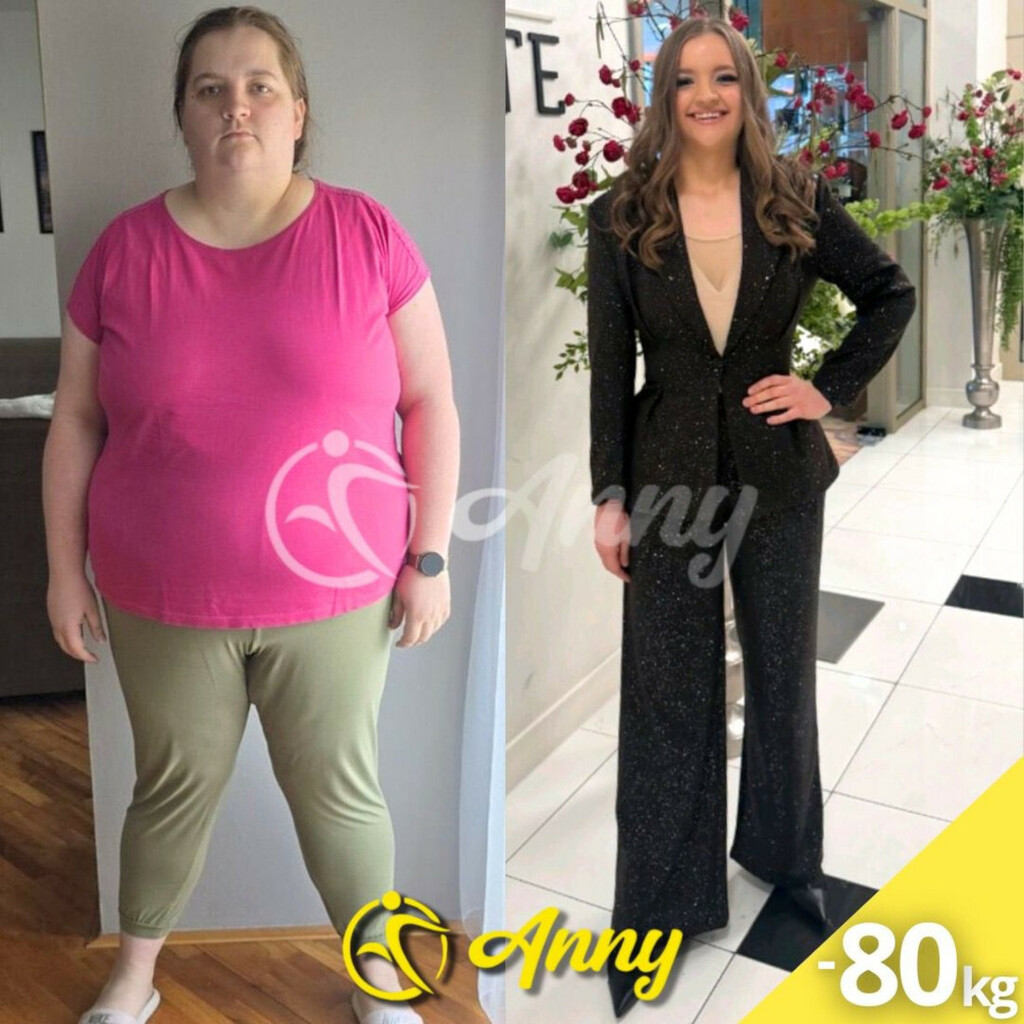 Matea Štangret iz Oriovca smršavjela je 81 kilogram - 2