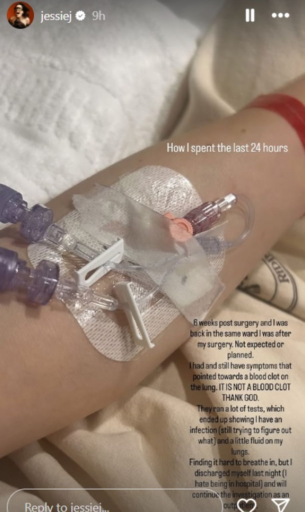 Jessie J na Instagramu