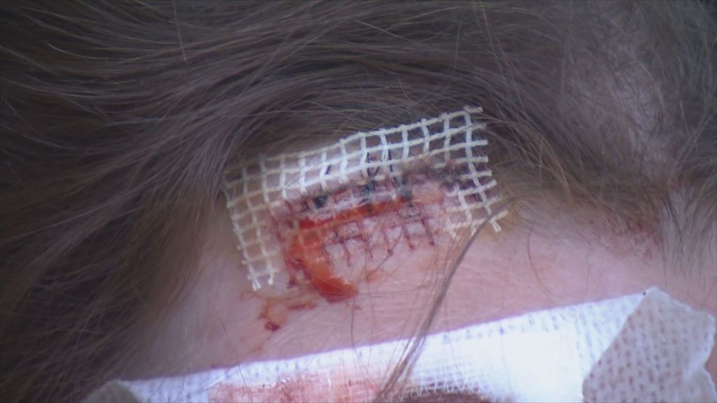 Pretučeni mladić - 3