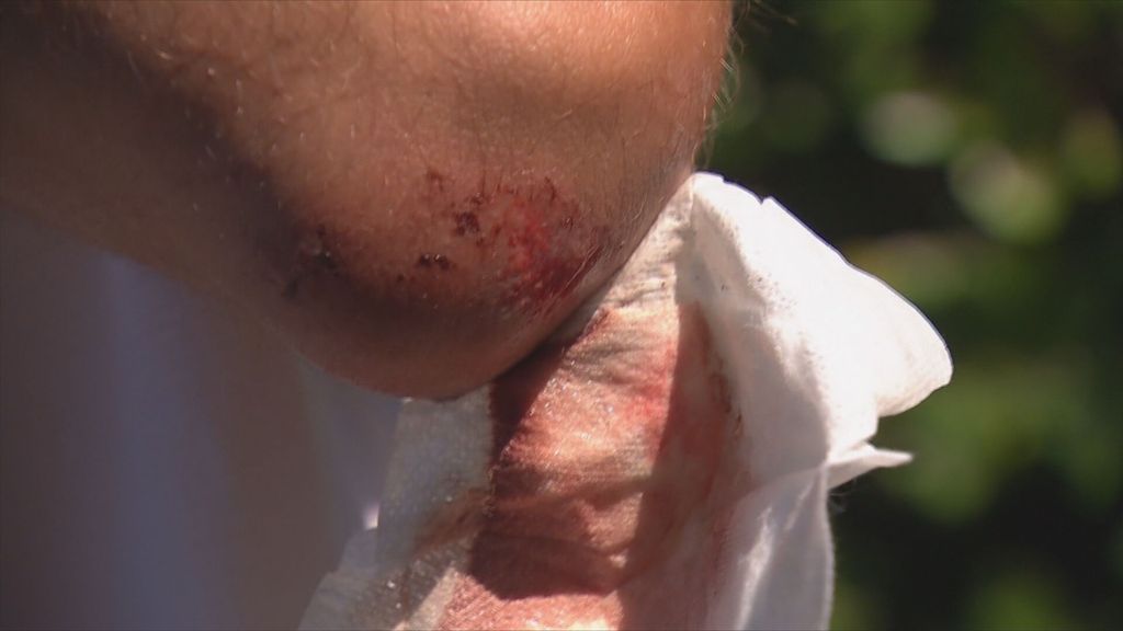 Pretučeni mladić - 3