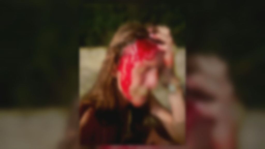 Slovenski turisti pretučeni u sukobu sa zaštitarima u Savudriji - 4