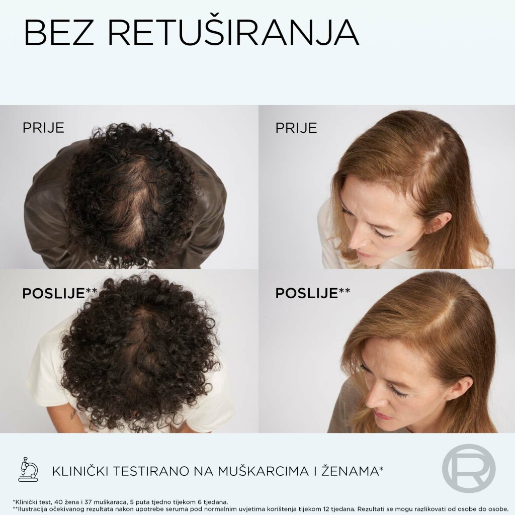 Prije i poslije korištenja Elseve Growth Booster rutine