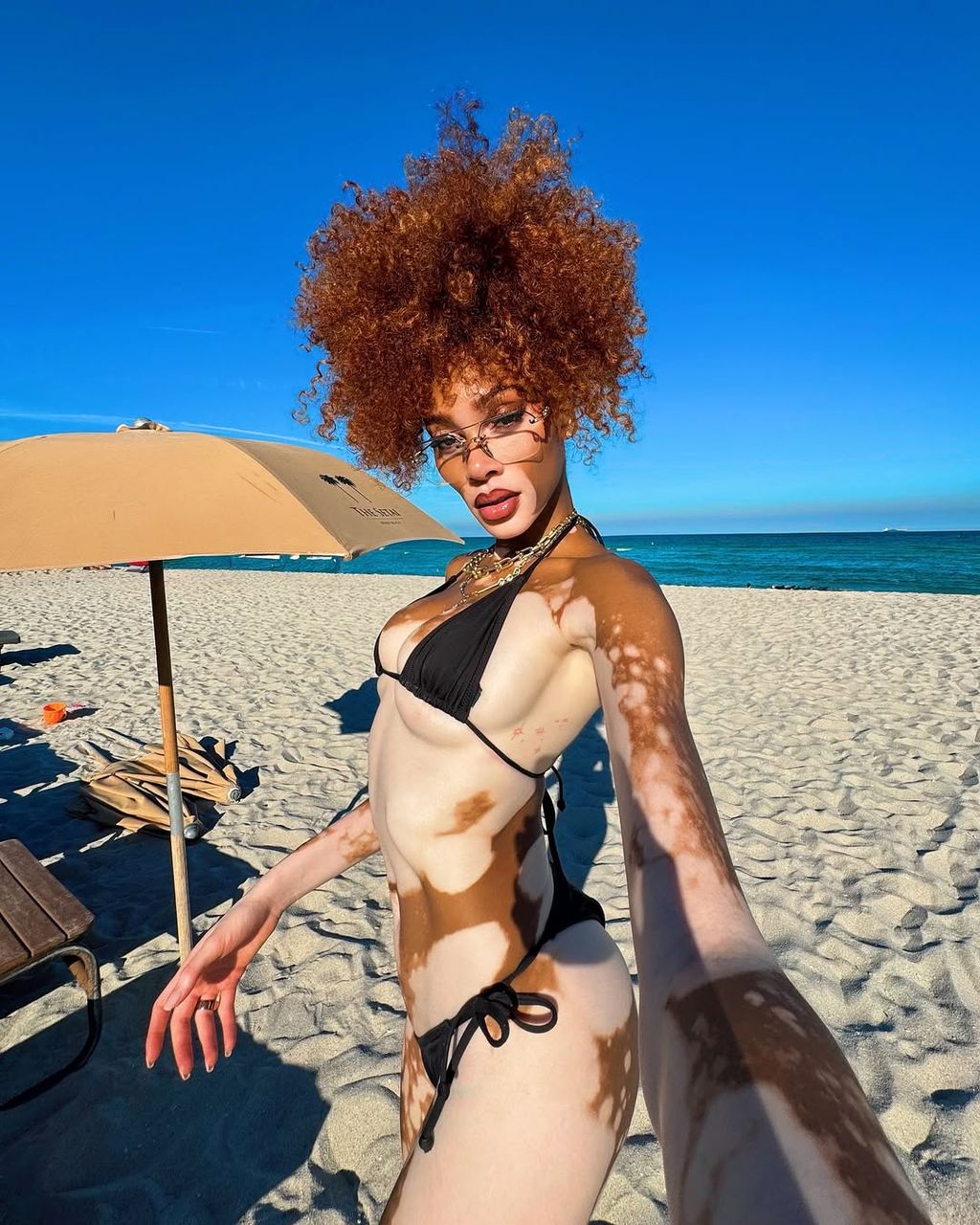 Winnie Harlow - 5