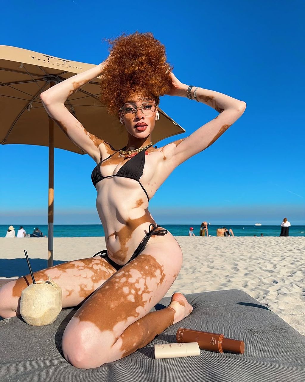Winnie Harlow - 7