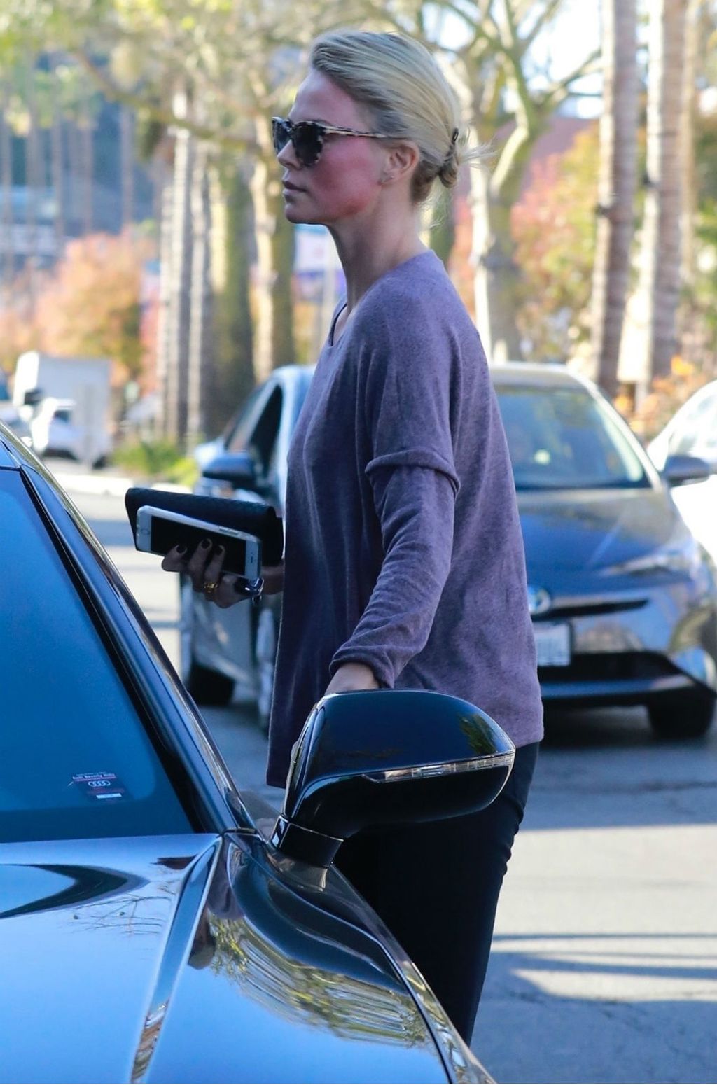 Slavne žene koje je dobar ten \'iznevjerio\' - 1