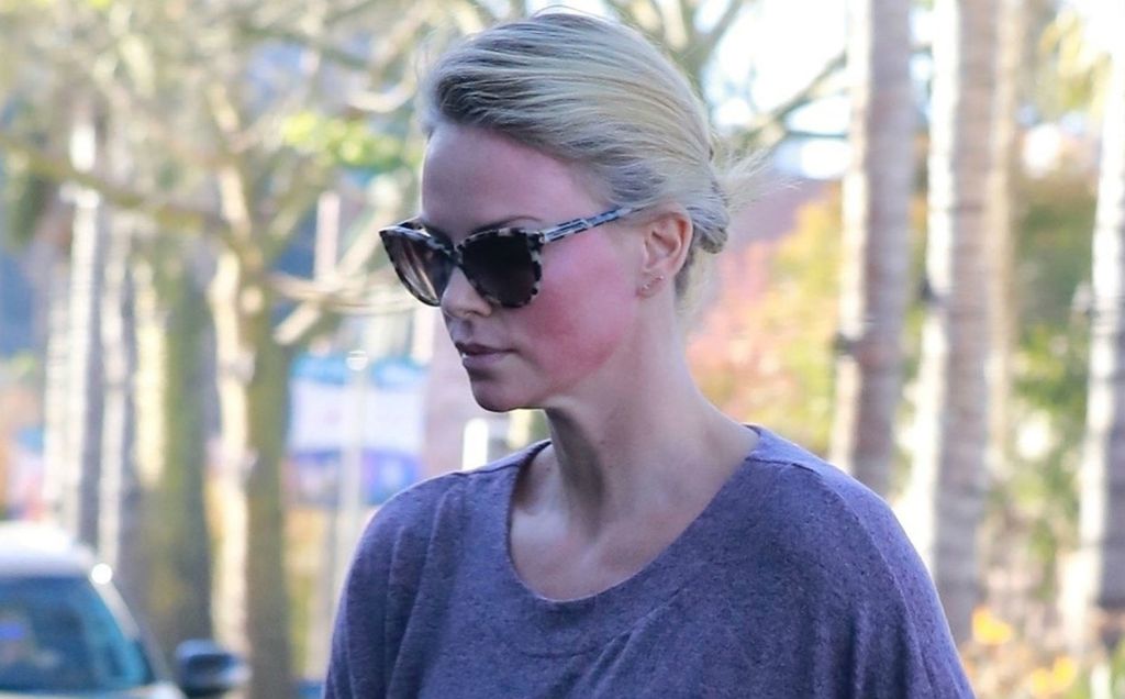 Slavne žene koje je dobar ten \'iznevjerio\' - 3