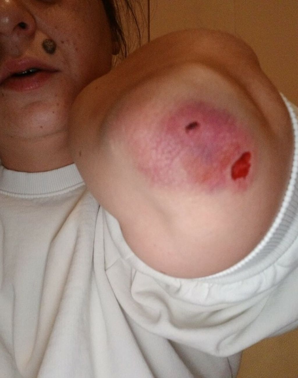 Napadnuta Nives Arnautović