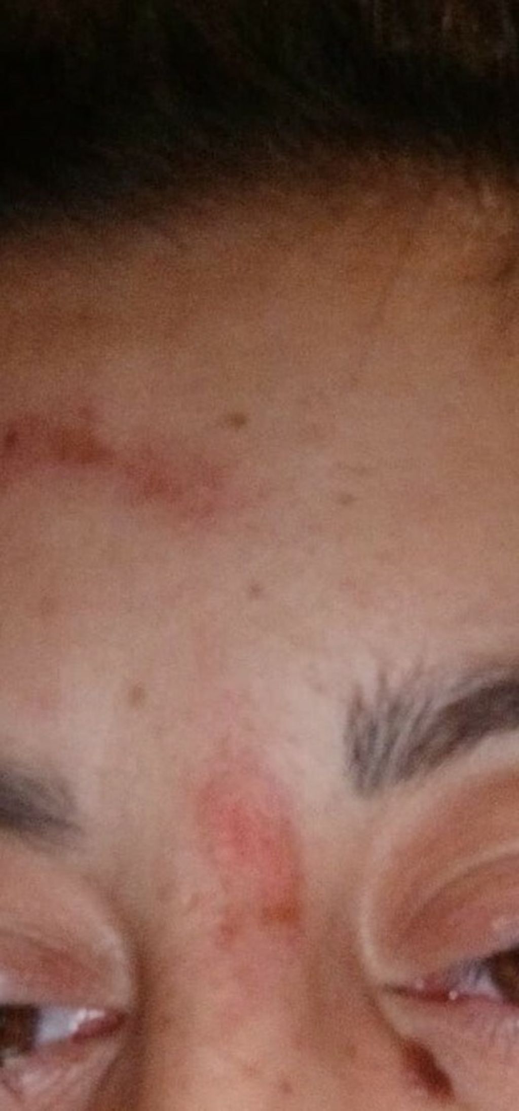 Napadnuta Nives Arnautović