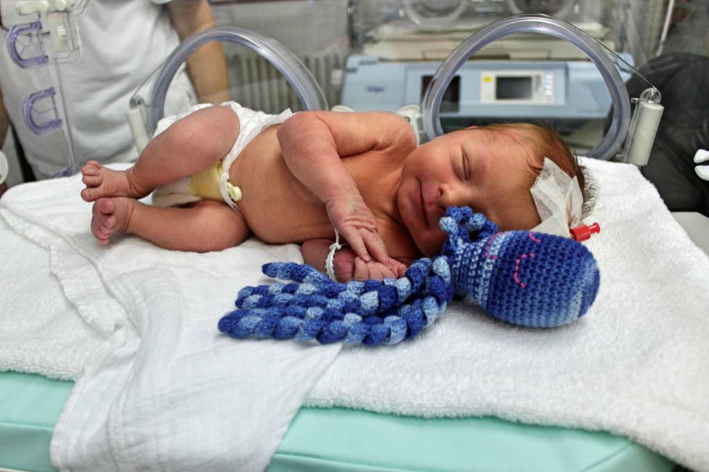 Opća bolnica Virovitica je među prvima u Hrvatskoj koja bebama nudi hobotnicu za smirenje i utjehu - 4