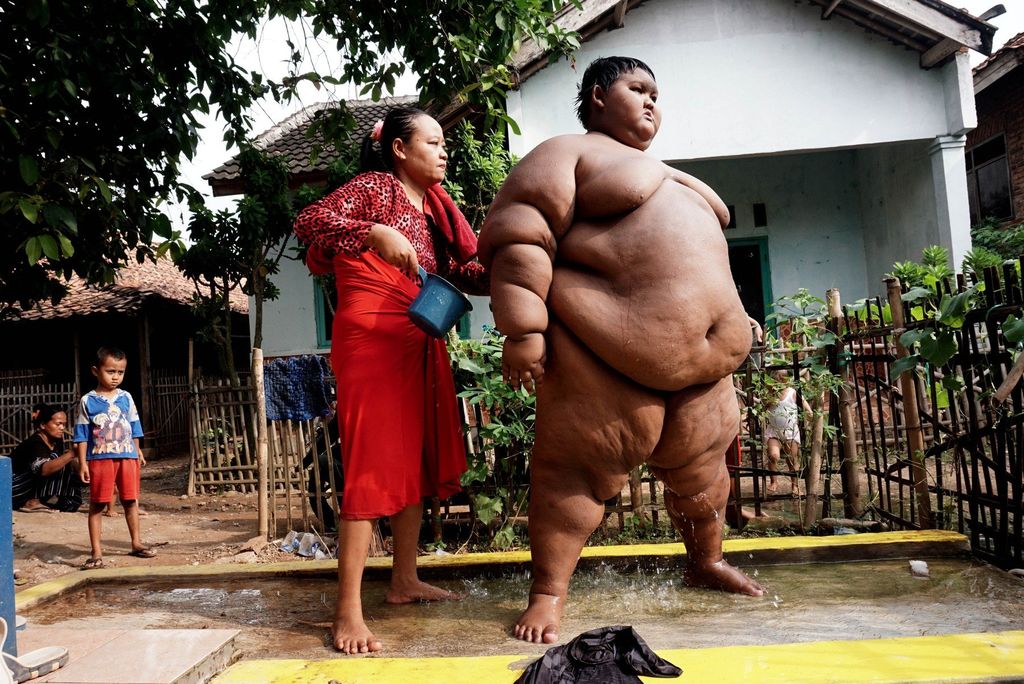 Najdeblji dječak na svijetu smršavio 75 kilograma (Foto: Profimedia)