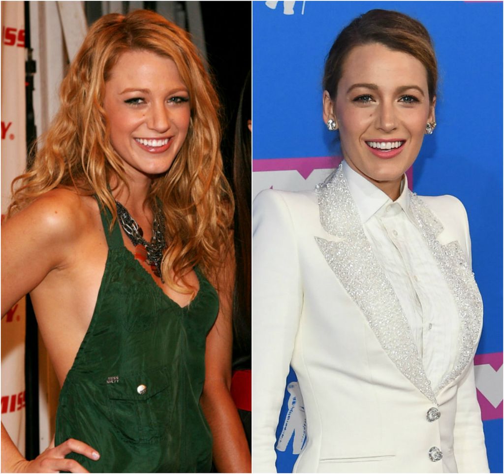 Blake Lively korigirala je nos