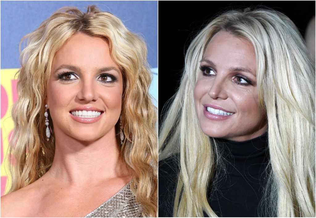 Britney Spears zavoljela je botoks