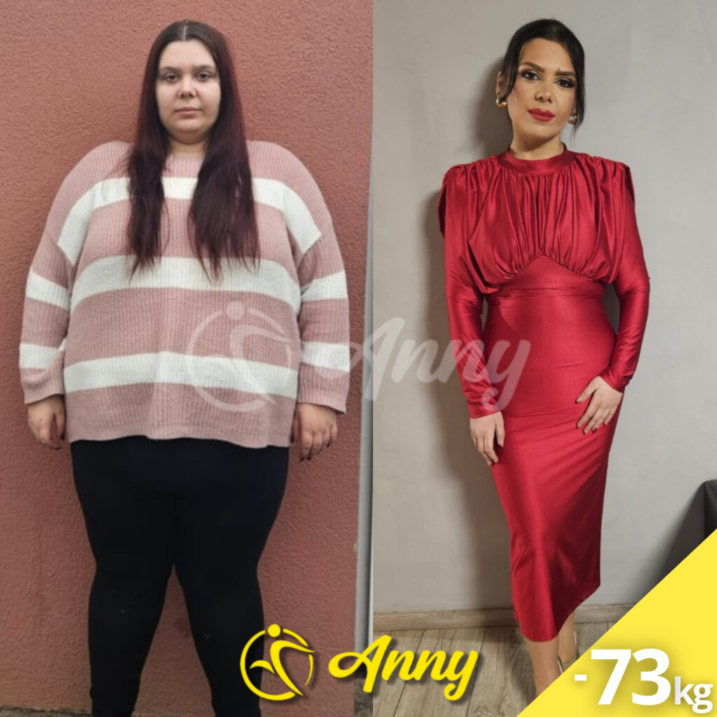 Ivana Mešić iz Čepina smršavjela je 73 kilograma - 2