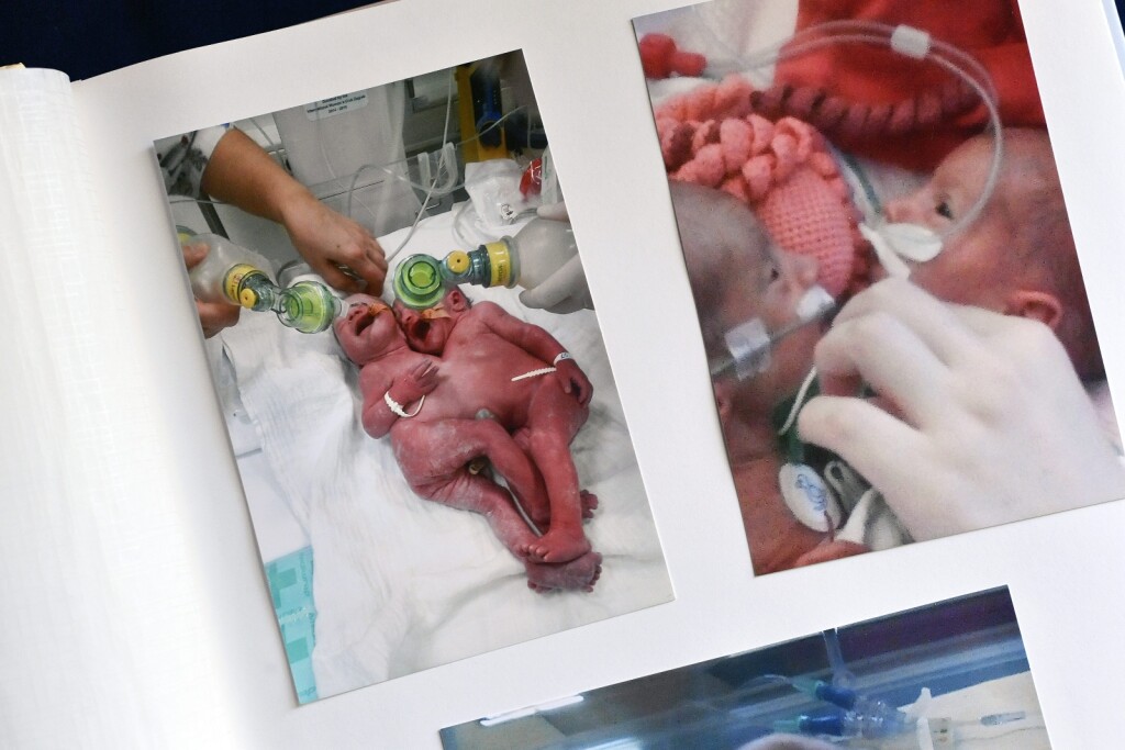 Valentina i Kristina Tambolaš