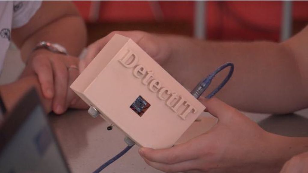 Pametna narukvica Pollinis