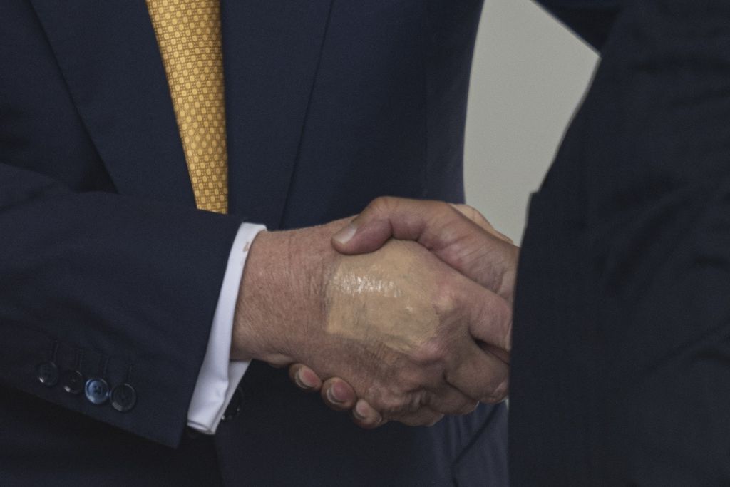 Što to skriva Donald Trump na ruci?
