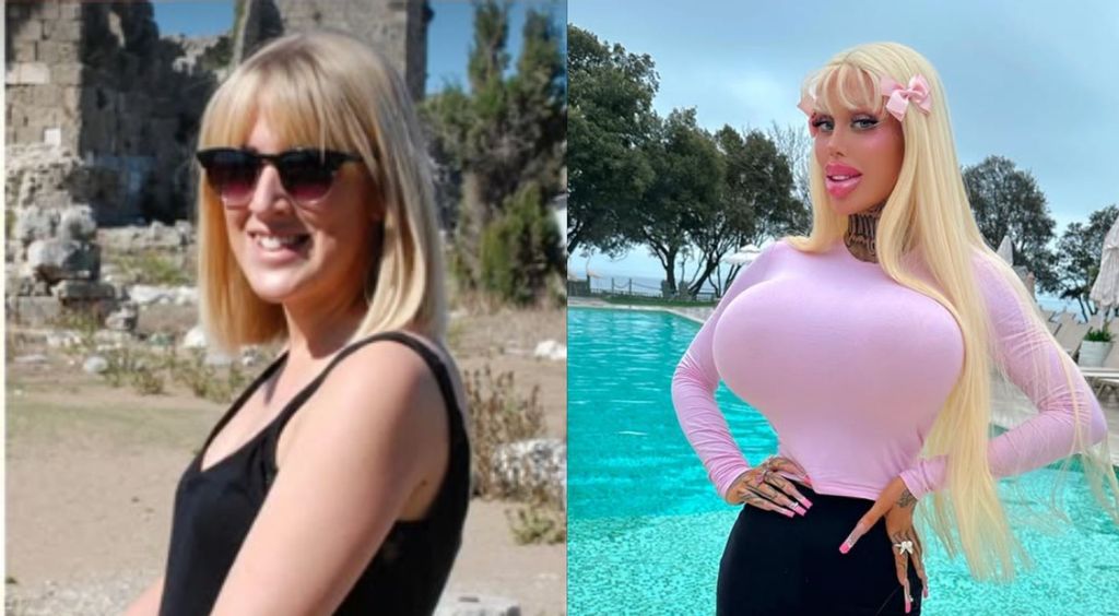 Alicia Amira prije i poslije operacije