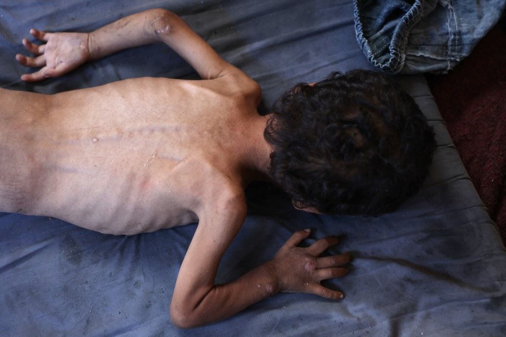 Djeca gladuju u Gazi