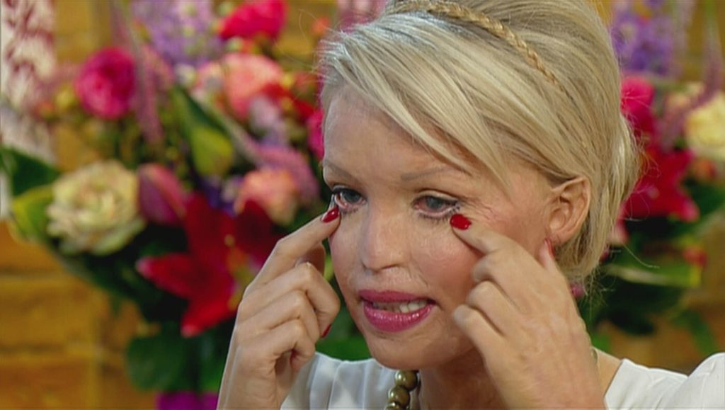 Katie Piper - 5