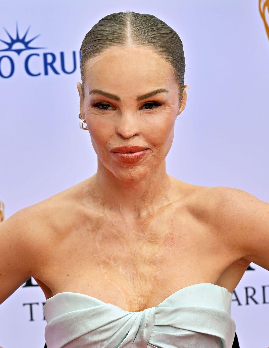 Katie Piper - 7