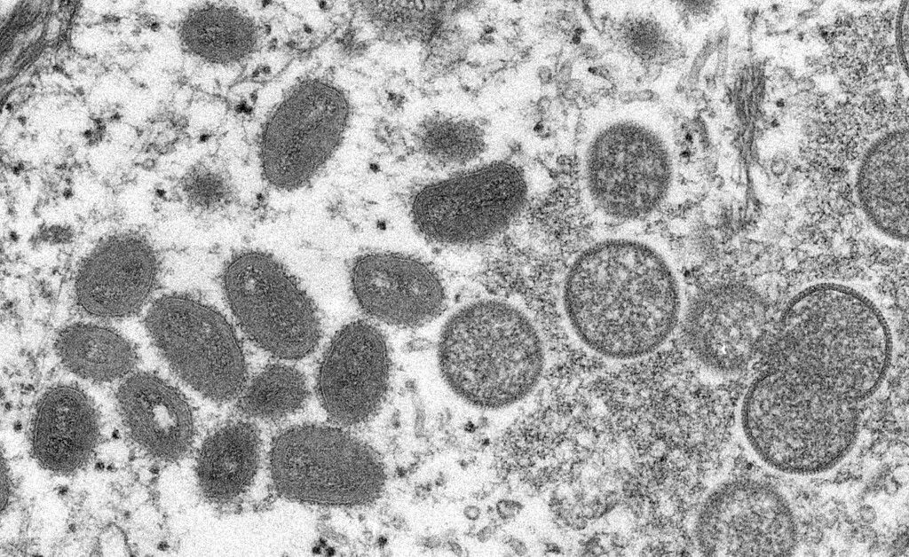 Virus mpoxa, ilustracija