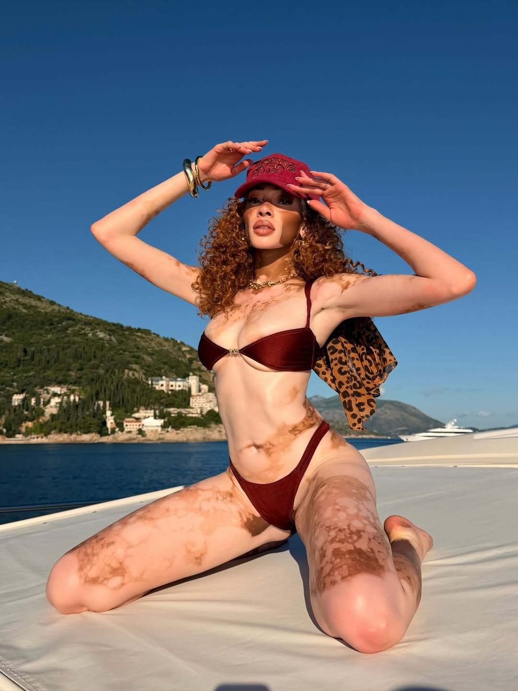 Winnie Harlow - 1
