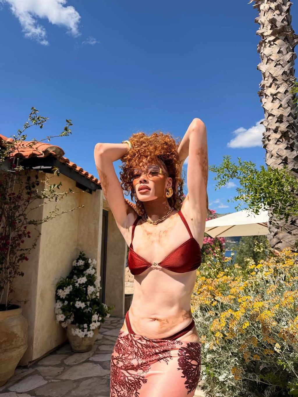 Winnie Harlow - 4