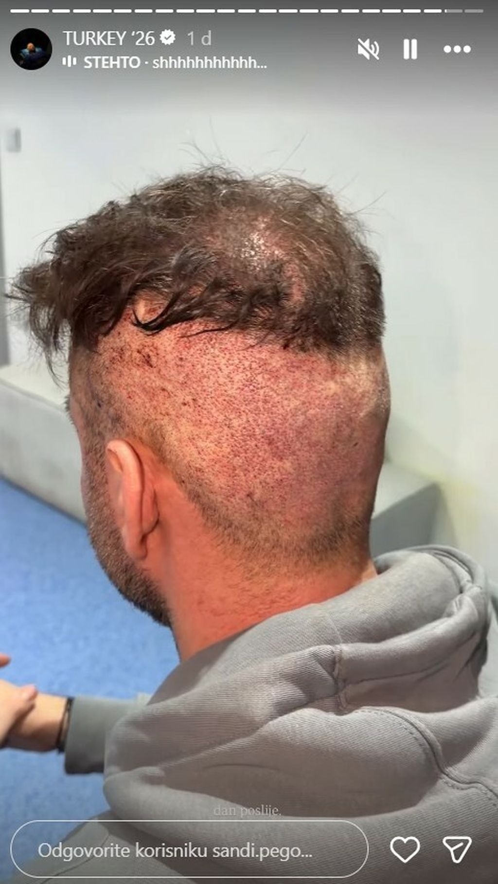 Sandi Pego na Instagramu