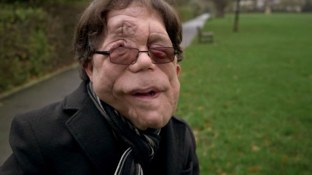 Adam Pearson - 1