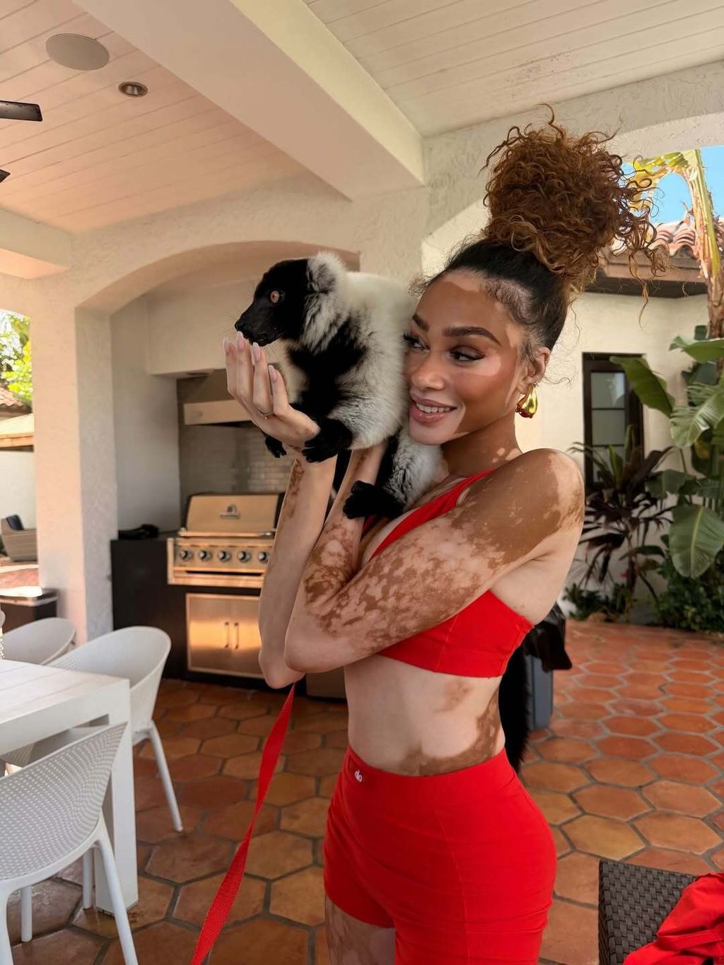 Winnie Harlow - 3