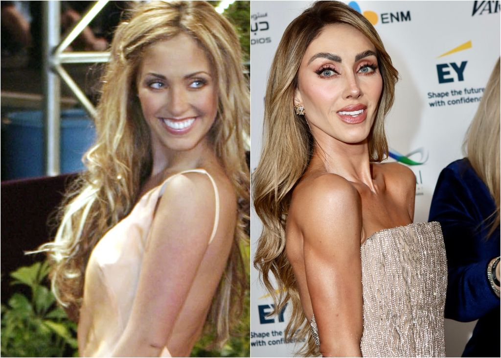 Anahi