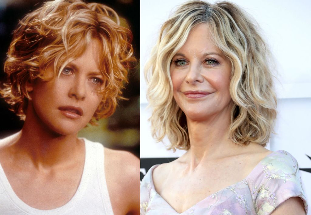 Slavne žene koje su bile ljepše prije plastične kirurgije - 3