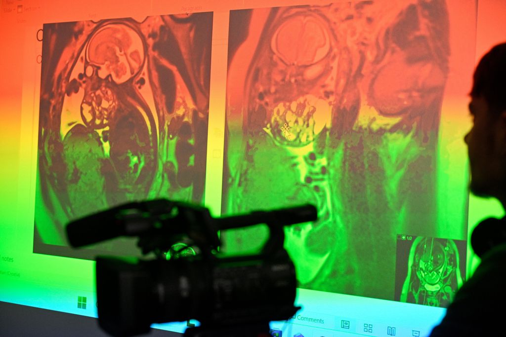 Novorođenče, ilustracija