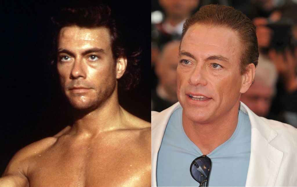 Muškarci s plastičnim operacijama, nekad i sad - 4