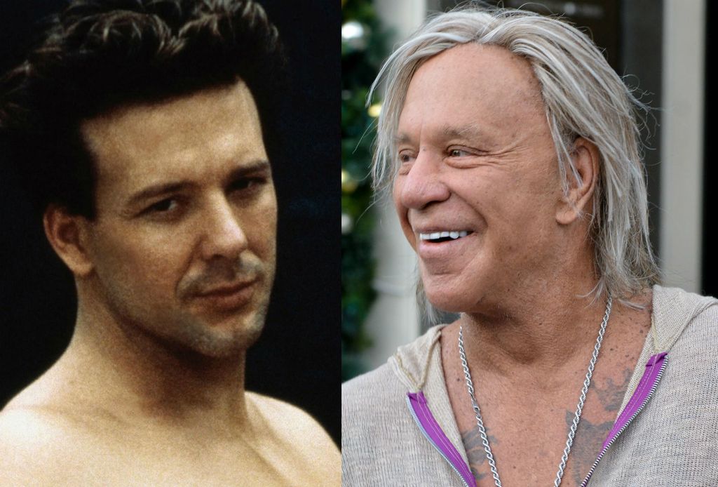 Muškarci s plastičnim operacijama, nekad i sad - 5