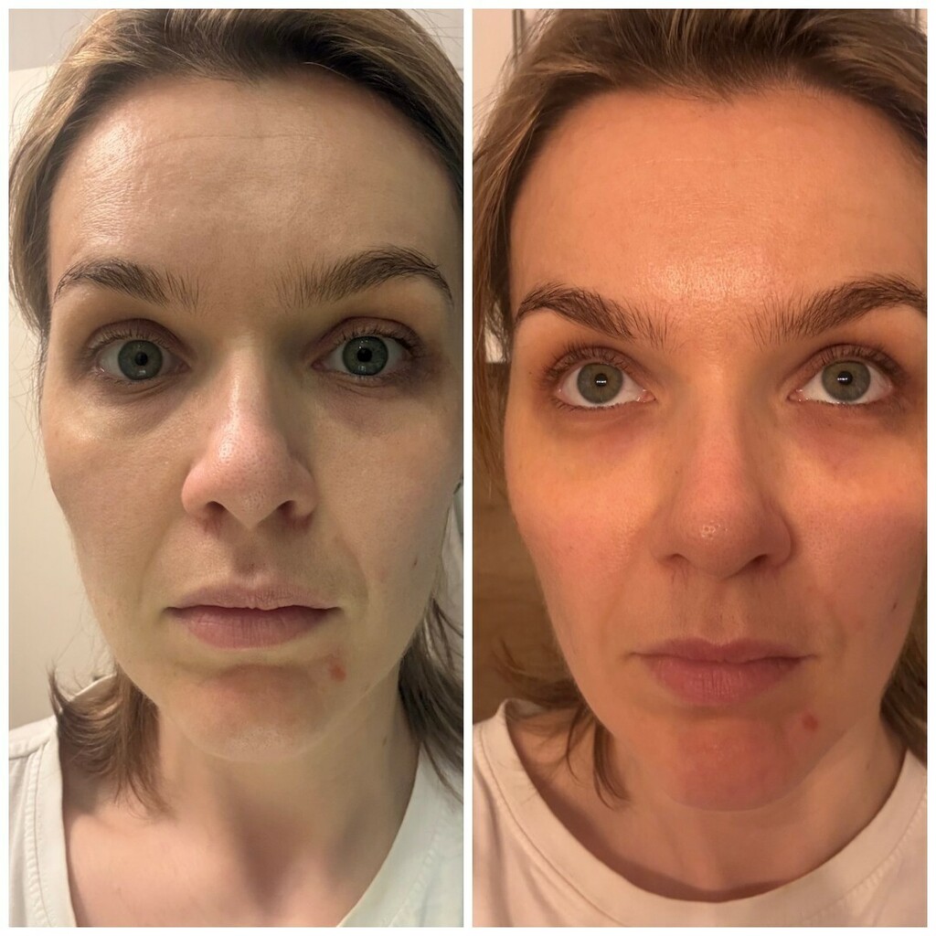 Zadovoljna recenzije: Čitateljice su isprobale kremu za instant korekciju vrećica ispod očiju