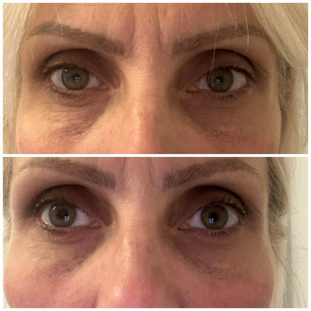 Zadovoljna recenzije: Čitateljice su isprobale kremu za instant korekciju vrećica ispod očiju