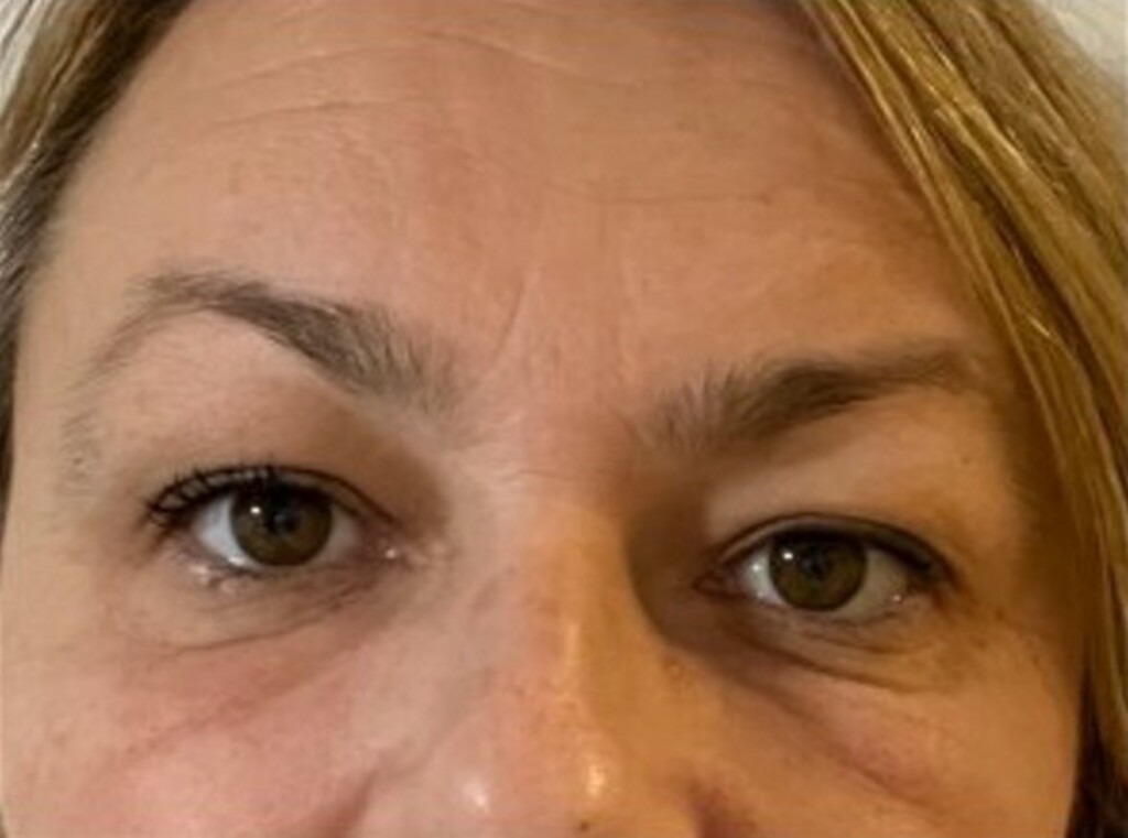 Zadovoljna recenzije: Čitateljice su isprobale kremu za instant korekciju vrećica ispod očiju