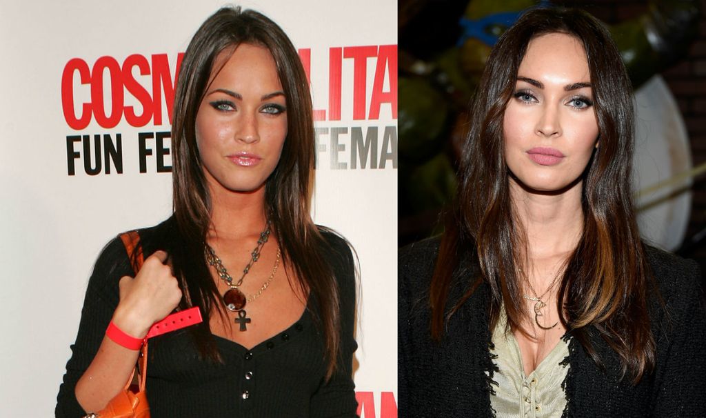 Nekad i sad: Slavne žene koje su povećale usne - 1