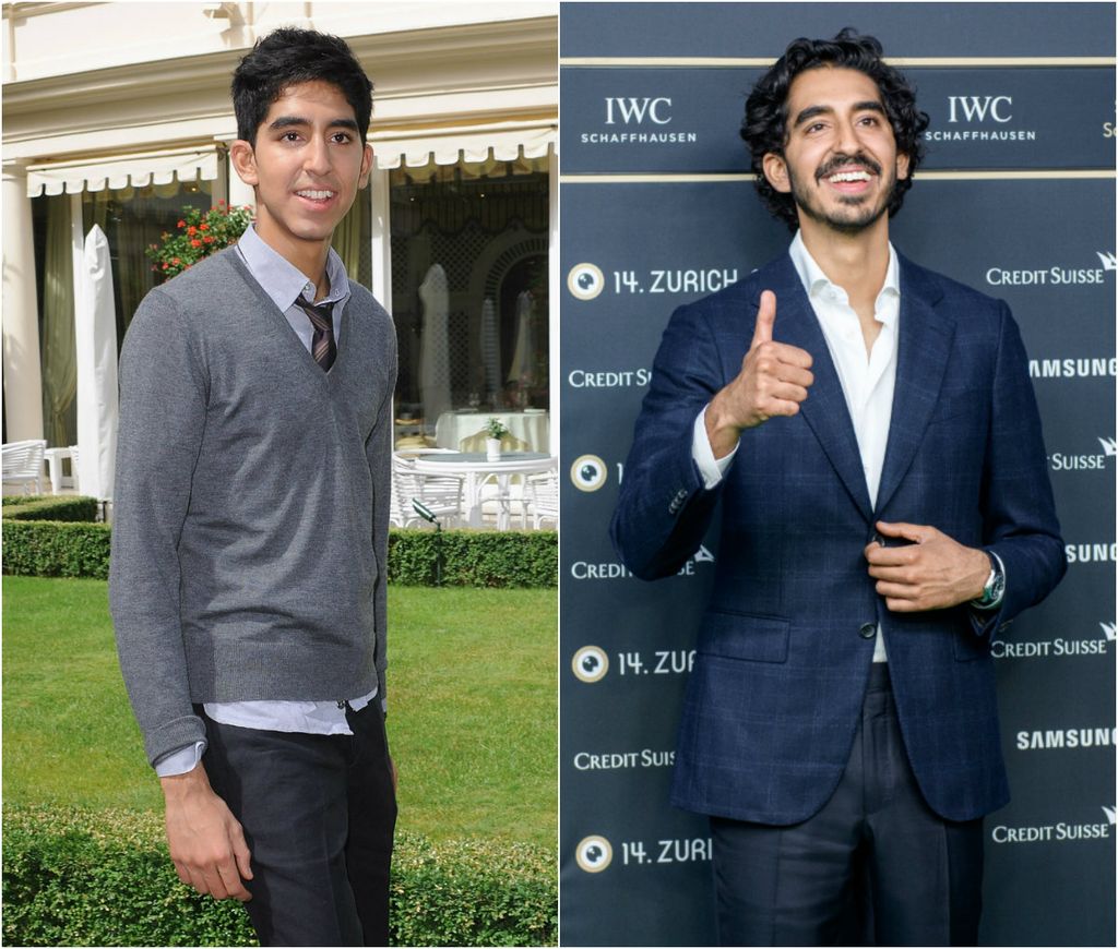 Dev Patel