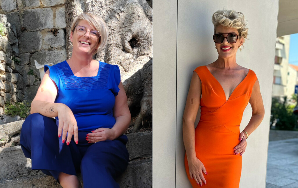 Marija Tešija iz Splita smršavjela je 26 kilograma - 8