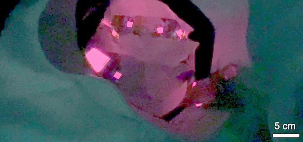 Kapa s OLED diodama za svjetlosnu terapiju vlasišta